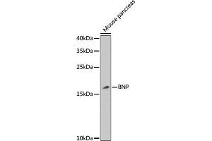Western blot analysis of extracts of Mouse pancreas using BNP Polyclonal Antibody at dilution of 1:1000. (BNP Antikörper)