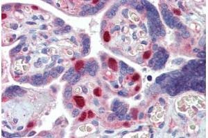 Placenta, Human: Formalin-Fixed, Paraffin-Embedded (FFPE) (MCL-1 Antikörper)