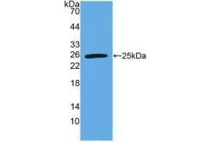 Detection of Recombinant VEGI, Human using Polyclonal Antibody to TNF Like Ligand 1A (TL1A) (TNF Like Ligand 1A (AA 67-251) Antikörper)