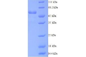 SDS-PAGE (SDS) image for Dynactin 4 (DCTN4) (AA 2-460) protein (His tag) (ABIN5714520)