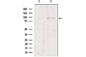 Western blot analysis of extracts from Mouse myeloma, using TMEM173/STING antibody. (STING/TMEM173 Antikörper  (Internal Region))