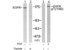 Image no. 1 for anti-Epidermal Growth Factor Receptor (EGFR) (pTyr1092) antibody (ABIN196760) (EGFR Antikörper  (pTyr1092))