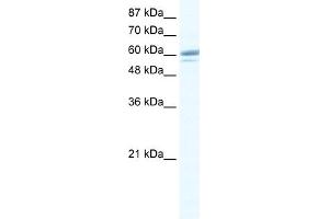 WB Suggested Anti-ZNF232 Antibody Titration:  0. (ZNF232 Antikörper  (Middle Region))