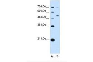 Image no. 2 for anti-Cerebellar Degeneration-Related Protein 2, 62kDa (CDR2) (N-Term) antibody (ABIN321833) (CDR2 Antikörper  (N-Term))