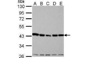 Western Blotting (WB) image for anti-Aurora Kinase A (AURKA) (C-Term) antibody (ABIN2855868)