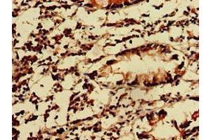 Immunohistochemistry of paraffin-embedded human appendix tissue using ABIN7157550 at dilution of 1:100 (KIDINS220 Antikörper  (AA 1077-1370))