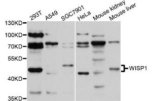 Western blot analysis of extracts of various cell lines, using WISP1 antibody (ABIN1875349) at 1:1000 dilution. (WISP1 Antikörper)