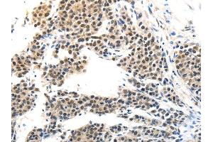 Immunohistochemistry (IHC) image for anti-Melanoma Antigen Family A, 6 (MAGEA6) antibody (ABIN5957147) (MAGEA6 Antikörper)