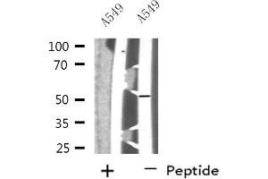 Western blot analysis of extracts from A549 cells, using NARFL antibody. (NARFL Antikörper  (Internal Region))