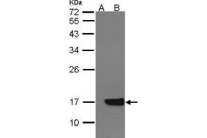 WB Image Western Blot analysis of CYB5A expression in transfected 293T cell line by CYB5A polyclonal antibody. (CYB5A Antikörper)