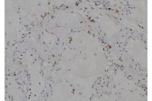 ABIN6277204 at 1/100 staining Human lung tissue by IHC-P. (Histone 3 Antikörper  (H3K79me))