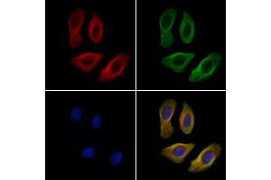 ABIN6263216 and ABIN6269229 staining Hela cells by IF/ICC. (MEK2 Antikörper  (C-Term))
