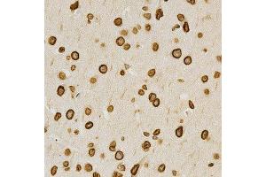 Immunohistochemistry of paraffin-embedded mouse brain using LMNA antibody at dilution of 1:200 (x400 lens). (Lamin A/C Antikörper  (AA 403-572))