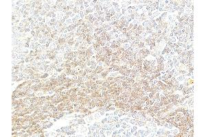Immunohistochemistry (IHC) image for anti-Tumor Necrosis Factor Receptor Superfamily, Member 14 (TNFRSF14) (AA 39-200) antibody (ABIN7449437)