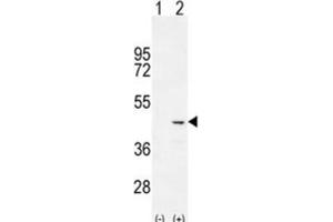 Western Blotting (WB) image for anti-Cochlin (COCH) antibody (ABIN2996145) (COCH Antikörper)