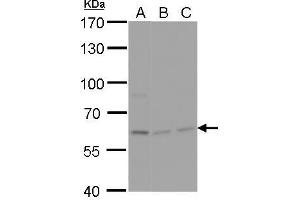 WB Image NPAS1 antibody detects NPAS1 protein by Western blot analysis. (NPAS1 Antikörper)