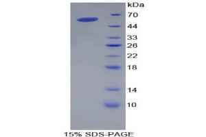 SDS-PAGE analysis of Pig Apolipoprotein A1 Protein.