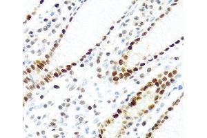 Immunohistochemistry of paraffin-embedded Human stomach using KHDRBS2 Polyclonal Antibody at dilution of 1:100 (40x lens). (KHDRBS2 Antikörper)
