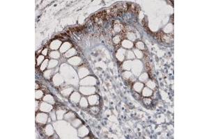 Immunohistochemical staining (Formalin-fixed paraffin-embedded sections) of human rectum with ABCD3 monoclonal antibody, clone CL2524  shows strong granular cytoplasmic immunoreactivity in glandular cells. (CX3CL1 Antikörper)