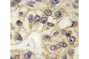 Immunohistochemistry (Formalin-fixed Paraffin-embedded Sections) (IHC (fp)) image for anti-CD14 (CD14) (AA 292-322) antibody (ABIN3030357)
