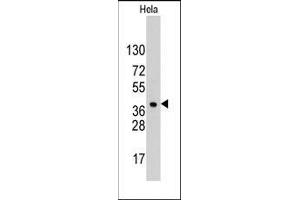 Western blot analysis of anti-HDGF Pab in Hela cell line lysates (35ug/lane). (HDGF Antikörper  (C-Term))