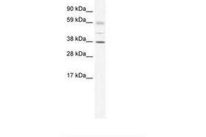 Image no. 1 for anti-SRY (Sex Determining Region Y)-Box 17 (SOX17) (AA 345-394) antibody (ABIN6735967)