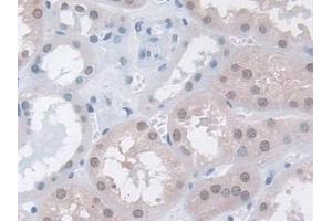 DAB staining on IHC-P; Samples: Human Kidney Tissue (MPP5 Antikörper  (AA 455-675))