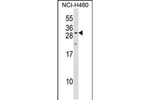 Western blot analysis in NCI-H460 cell line lysates (35ug/lane). (MPZL2 Antikörper  (AA 67-94))