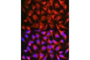 Immunofluorescence analysis of HeLa cells using [KO Validated] CD171/L1CAM Rabbit pAb (ABIN6131538, ABIN6143053, ABIN6143054 and ABIN7101826) at dilution of 1:150 (40x lens). (L1CAM Antikörper  (AA 1143-1257))
