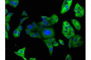 Immunofluorescence staining of HepG2 cells with ABIN7164832 at 1:166, counter-stained with DAPI. (PCSK9 Antikörper  (AA 153-380))