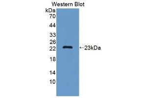 anti-Splicing Factor 3b, Subunit 3, 130kDa (SF3B3) (AA 35-210) antibody