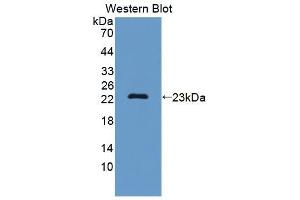 Detection of Recombinant SF3B3, Mouse using Polyclonal Antibody to Splicing Factor 3B Subunit 3 (SF3B3) (SF3B3 Antikörper  (AA 35-210))