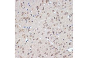 Immunohistochemistry of paraffin-embedded mouse brain using XPD/ERCC2 Rabbit mAb (ABIN7267057) at dilution of 1:100 (40x lens). (ERCC2 Antikörper)