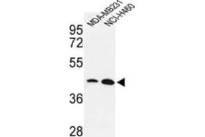 Western Blotting (WB) image for anti-Kruppel-Like Factor 4 (Gut) (KLF4) antibody (ABIN3001588)