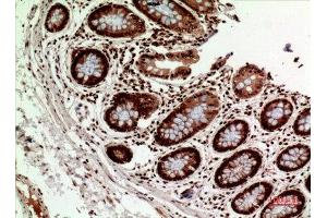 Immunohistochemistry (IHC) analysis of paraffin-embedded Human Colon, antibody was diluted at 1:100. (HLA-DQ1/DQ2 Antikörper  (Internal Region))