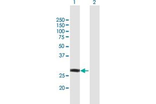 NSMCE1 Antikörper  (AA 1-256)