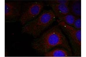 Image no. 1 for anti-Synuclein, alpha (SNCA) (pTyr125) antibody (ABIN401547) (SNCA Antikörper  (pTyr125))