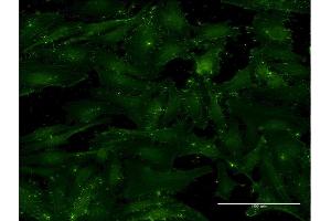 Immunofluorescence of monoclonal antibody to CD9 on HeLa cell. (CD9 Antikörper  (AA 112-195))