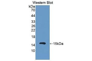Western Blotting (WB) image for anti-Complement Factor B (CFB) (AA 474-590) antibody (ABIN1858373) (Complement Factor B Antikörper  (AA 474-590))