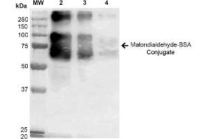Western blot analysis showing detection of 67 kDa Malondialdehyde BSA Conjugate (ABIN5564152, ABIN5564153 and ABIN5564154) using Anti-Malondialdehyde Antibody, Clone 6H6 (SMC-514).