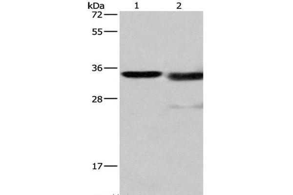 Cathepsin L Antikörper