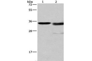 Western Blot analysis of Mouse kidney tissue and A172 cell using Cathepsin L Polyclonal Antibody at dilution of 1:900 (Cathepsin L Antikörper)