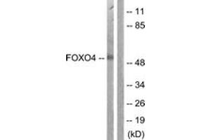 Western blot analysis of extracts from K562 cells, using FOXO4 (Ab-451) Antibody. (FOXO4 Antikörper  (AA 417-466))