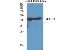 Western Blot (WB) analysis of specific cells using MEK-1/2 Polyclonal Antibody. (MEK1/2 Antikörper  (Ser112))