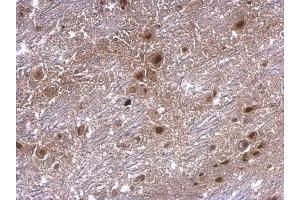 IHC-P Image axin 2 antibody [N2C2], Internal detects axin 2 protein at cytosol on mouse hind brain by immunohistochemical analysis. (AXIN2 Antikörper)