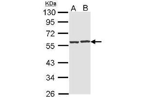 WB Image Sample (30 ug of whole cell lysate) A: Hep G2 , B: Raji 10% SDS PAGE antibody diluted at 1:1000 (CAP1 Antikörper  (Center))