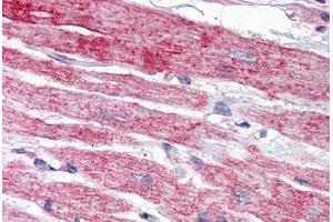 Human Heart (formalin-fixed, paraffin-embedded) stained with NPTX2 antibody ABIN343900 at 5 ug/ml followed by biotinylated goat anti-rabbit IgG secondary antibody ABIN481713, alkaline phosphatase-streptavidin and chromogen. (NPTX2 Antikörper  (Internal Region))