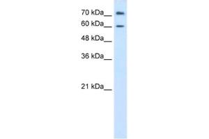 Western Blotting (WB) image for anti-Proline Dehydrogenase (Oxidase) 2 (PRODH2) antibody (ABIN2462440) (PRODH2 Antikörper)