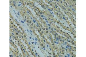 Immunohistochemistry of paraffin-embedded Mouse kidney using UBE2I Polyclonal Antibody at dilution of 1:100 (40x lens).