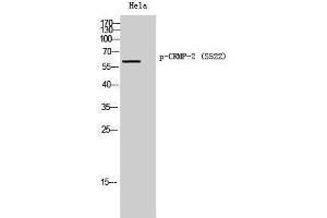 Western Blotting (WB) image for anti-Dihydropyrimidinase-Like 2 (DPYSL2) (pSer522) antibody (ABIN3182401) (DPYSL2 Antikörper  (pSer522))